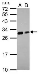 14-3-3 theta antibody