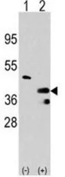 PRMT1 antibody