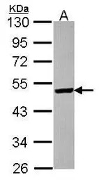 ST3GAL5 antibody [N3C3]