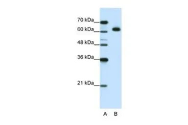 DIS3L2 antibody, N-term