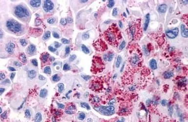 VIP receptor 1 antibody