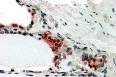 TRIP15 antibody, C-term