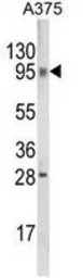 C6orf170 antibody, N-term