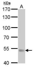 UGT1A antibody