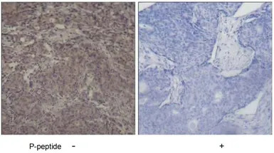 SMAD3 (phospho Ser425) antibod