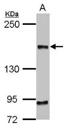 CEP164 antibody [17]