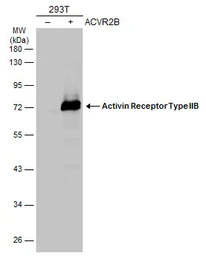 Activin Receptor Type IIB anti