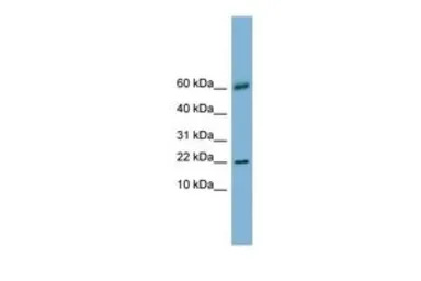 LGALS14 antibody, N-term