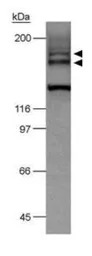 VEGF Receptor 2 antibody