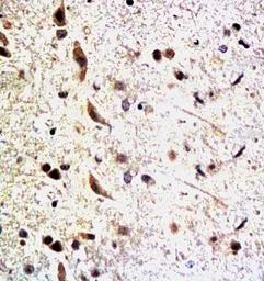Neurofascin 155 antibody