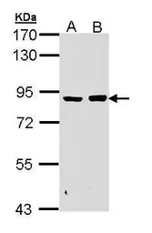 PFKM antibody [C1C3]