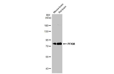 PFKM antibody [C1C3]