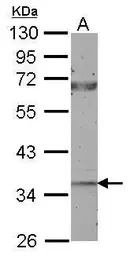 CTGF antibody