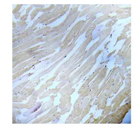 IKK alpha (phospho Ser180) + I