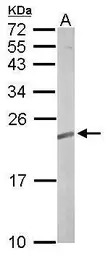 TC21 antibody [N1C3]