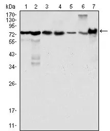LPP antibody [8B3A11]