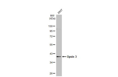 Opsin 3 antibody [N1], N-term