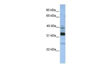 TXNDC13 antibody, C-term