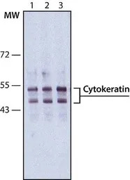 pan Cytokeratin antibody [PCK-
