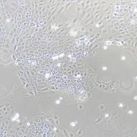 SCaBER、SCaBER细胞、SCaBER细胞、SCaBER细胞、人膀胱鳞癌细胞/STR鉴定/镜像绮点（Cellverse）