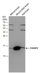 CRABP2 antibody [N1C3]