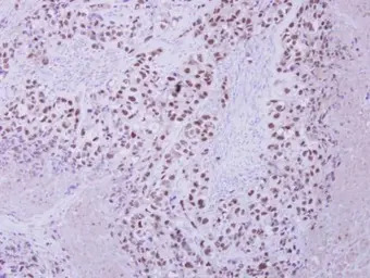 ZNF217 antibody [N3C2], Intern