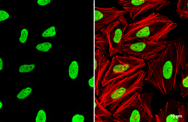 KAP1 antibody [N3C2], Internal