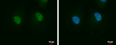 AIMP2 antibody [N2C3]