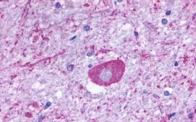 TM7SF1/GPR137B antibody