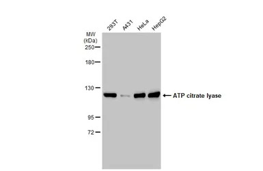 ATP citrate lyase antibody [N1