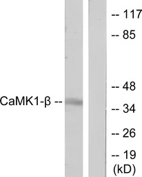 CaMKI beta antibody