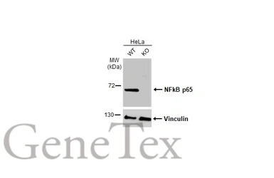 NFkB p65 antibody