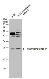 Thymidine Kinase 1 antibody
