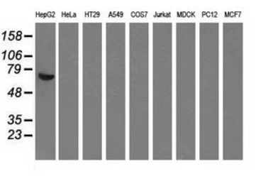 Alpha fetoprotein / AFP antibo