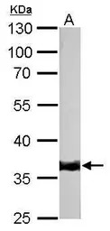 Tropomyosin 1 antibody