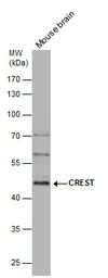 CREST antibody [C1C3]