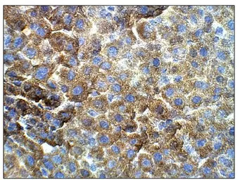 Vitamin K epoxide reductase an