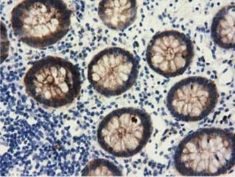 ALDH1L1 antibody [6A10]