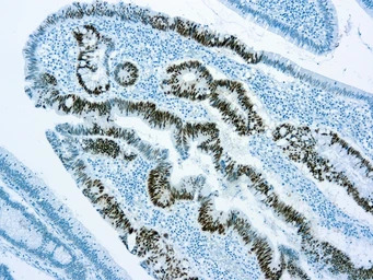 p53 antibody [DO-7] (ready-to-