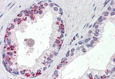 Annexin A1 antibody, C-term