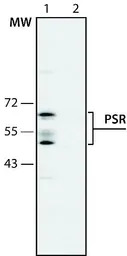 PSR antibody