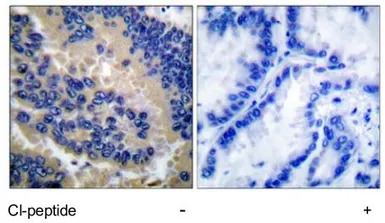 Caspase 3 (cleaved Asp175) ant