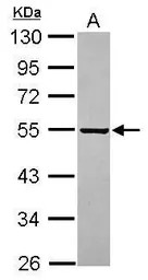 PARS2 antibody [C1C3]
