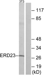 KDELR3 antibody