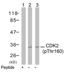 CDK2 (phospho Thr160) antibody