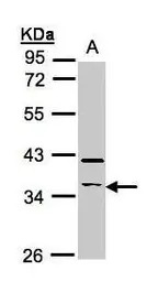 RASSF2 antibody [N1C3]