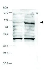 HIF2 alpha antibody [ep190b]
