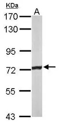 ACADVL antibody [N1C1]