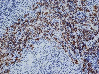 CD163 antibody [ED2]