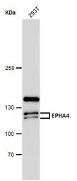 EphA4 antibody [N3C2-2], Inter